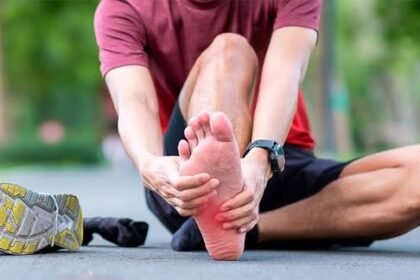 fascitis plantar