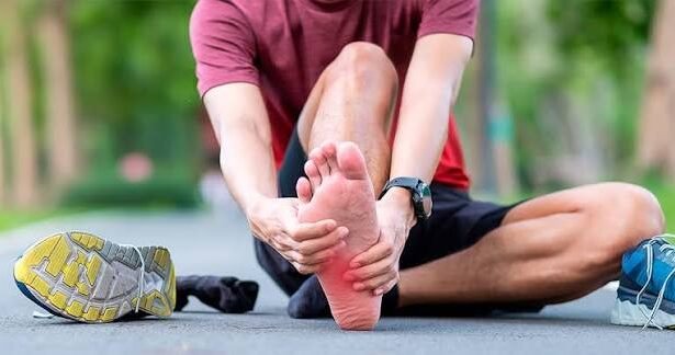 fascitis plantar
