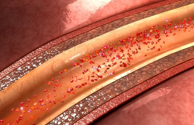 microplasticos